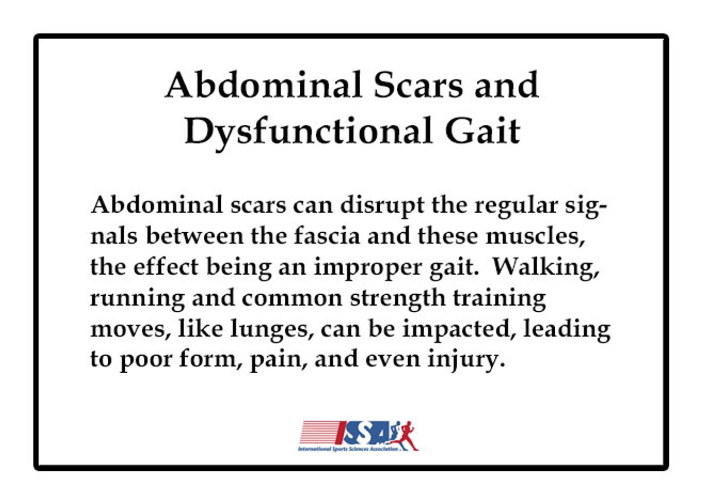 Abdominal scars can disrupt the regular signals between the fascia and these muscles, the effect being an improper gait.