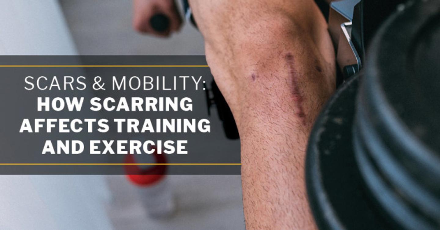 Scars & Mobility: How Scarring Affects Training and Exercise, ISSA, International Sports Sciences Association, Certified Personal Trainer, ISSAonline