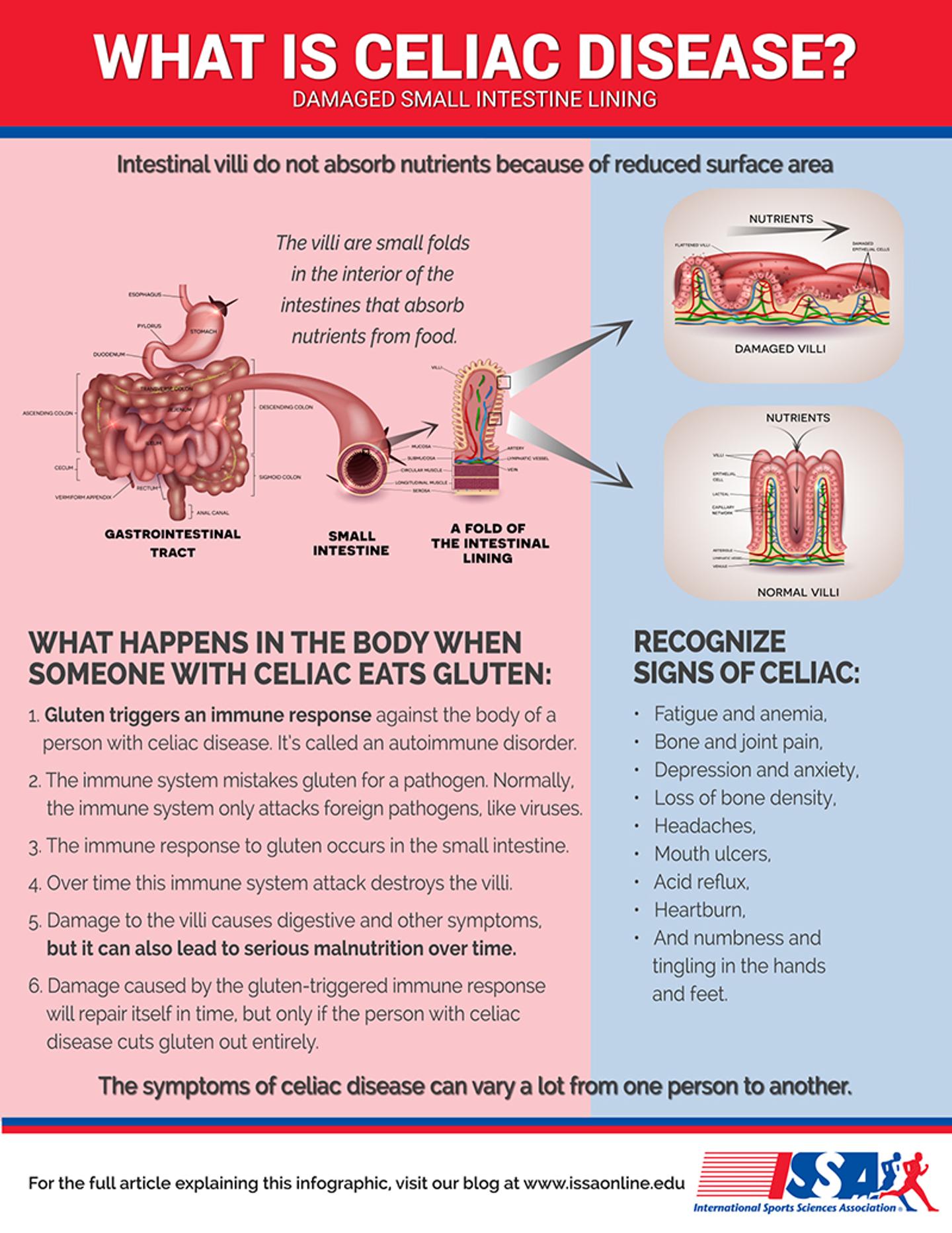 celiac infographic embedded image