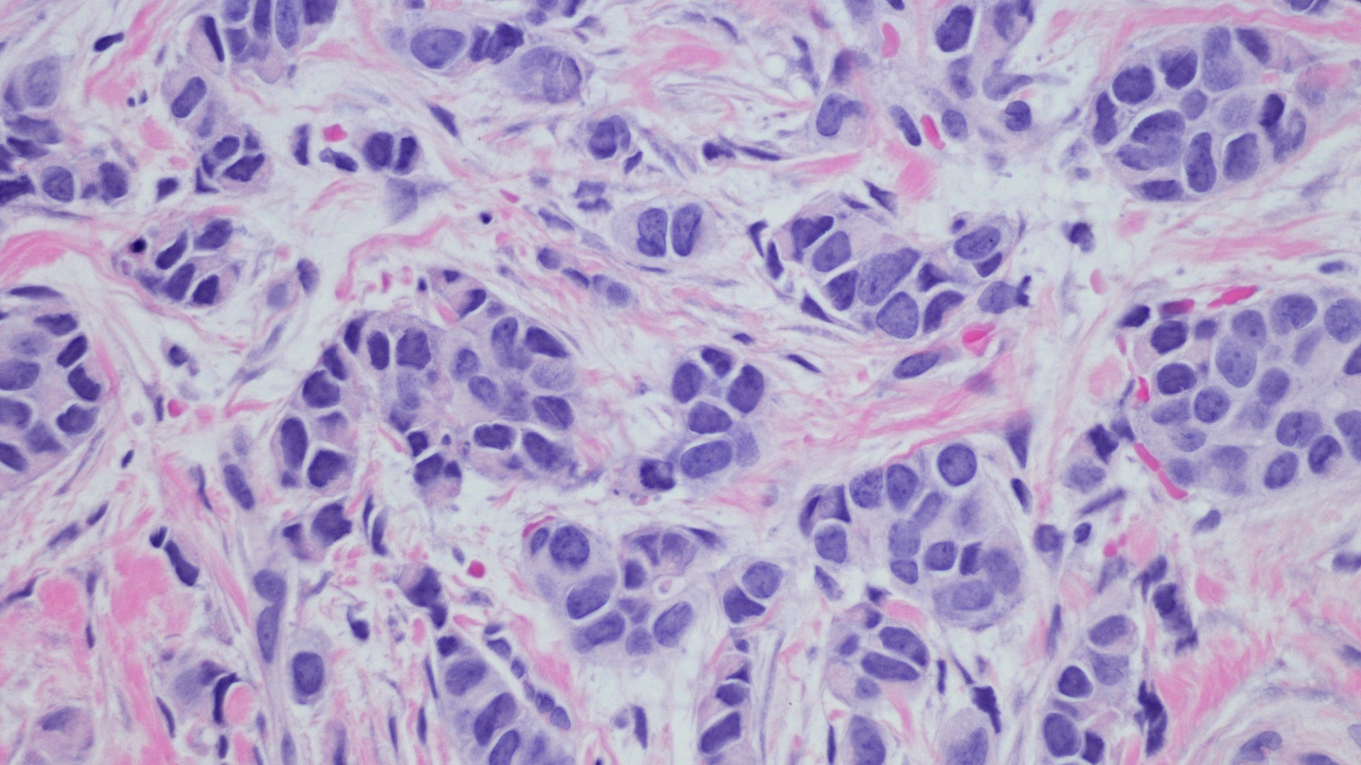 FXNA | Estrogen dominance and breast cancer prevention: A Functional Nutrition approach-image