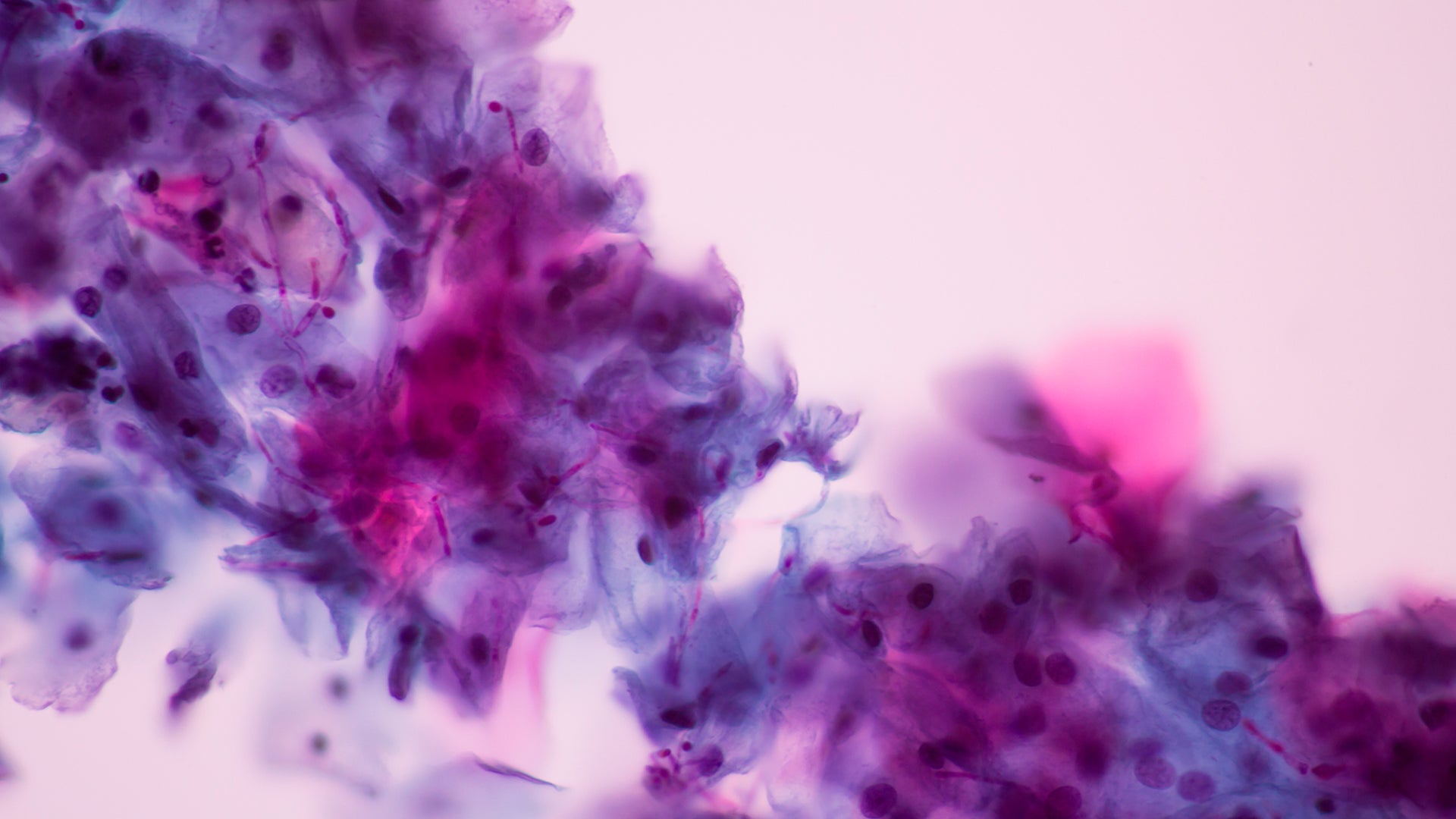 FXNA | A Functional Understanding of The Role of Microflora in Candida Overgrowth-image