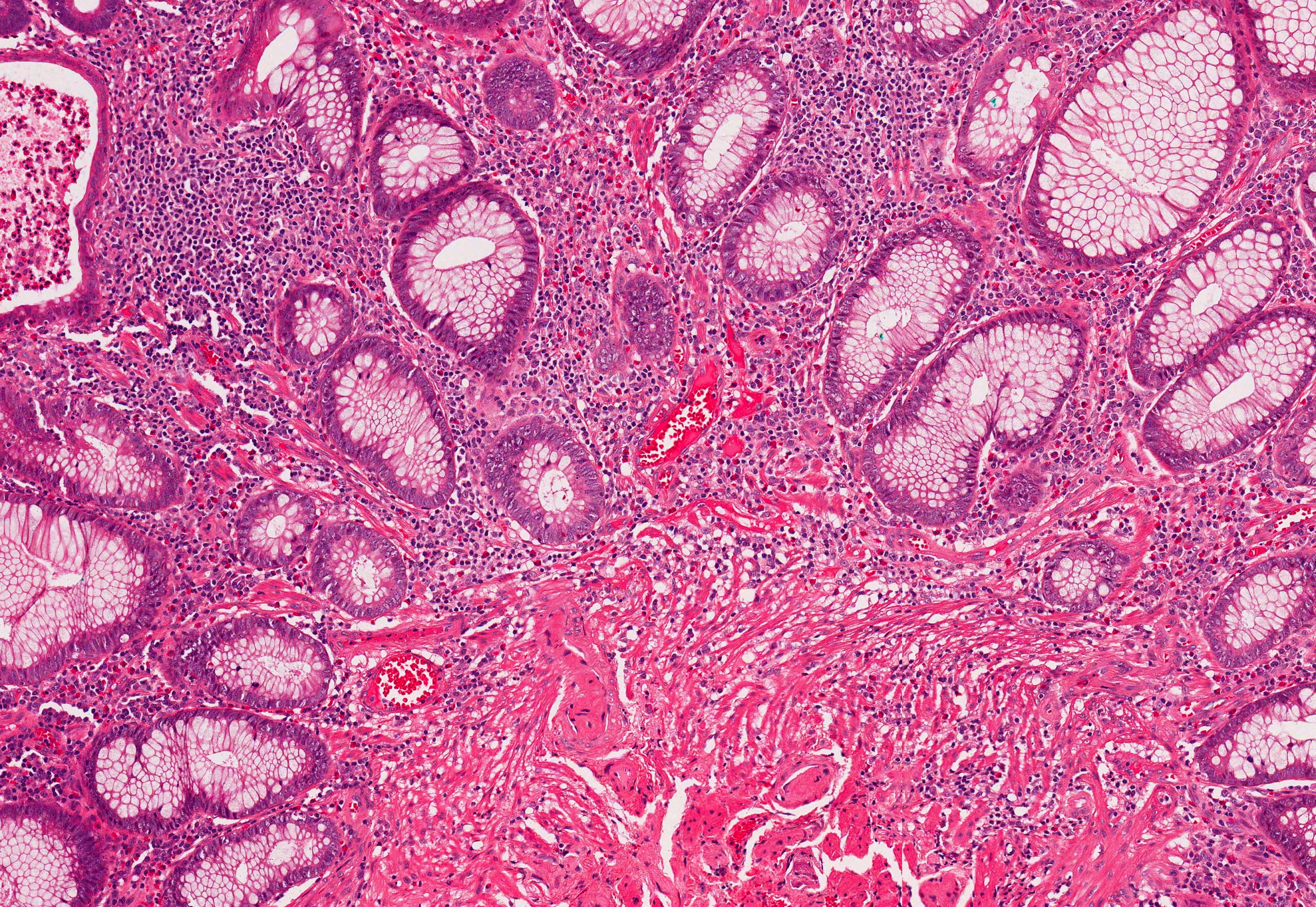 the gut-brain connection - Blog Image